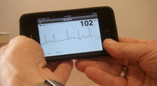 Iphone App detects heart rhythm that could lead to stroke