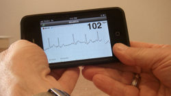 University of Sydney Researchers build iPhone App that detects heart conditions that lead to stroke