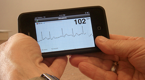 Iphone App detects heart rhythm that could lead to stroke
