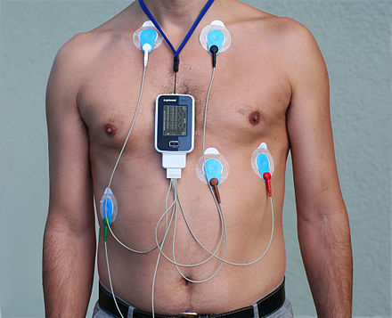 Holter Monitor - Credit Wikipedia